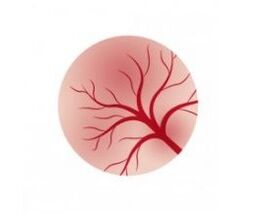 Inflammation of the bladder mucosa and treatment with fan capsules